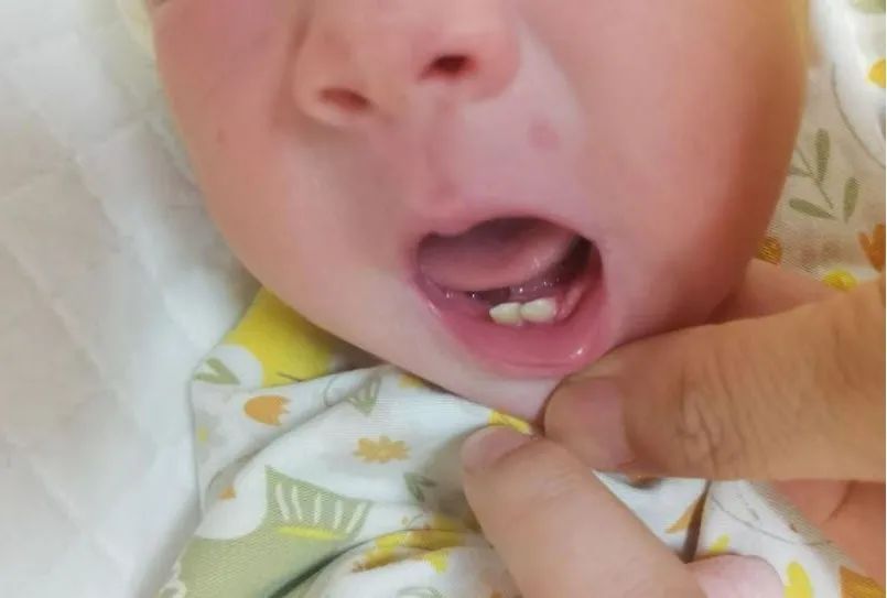 罕见!杭州此地发现一例 罕见!杭州此地发现一例