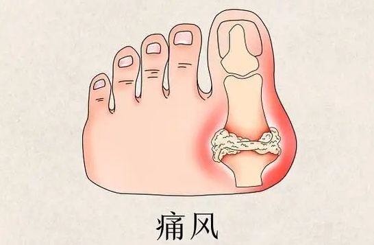 警惕!浙江一高校50名学生确诊! 警惕!浙江一高校50名学生确诊!