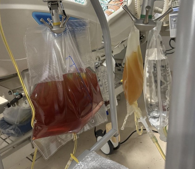 女子舍不得吃,老公吃完直接躺进ICU!医生:1个就能致命 女子舍不得吃,老公吃完直接躺进ICU!医生:1个就能致命