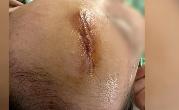 5岁男孩在游泳馆摔倒受伤,摔倒处没铺防滑垫!家长索赔却…… 5岁男孩在游泳馆摔倒受伤,摔倒处没铺防滑垫!家长索赔却……