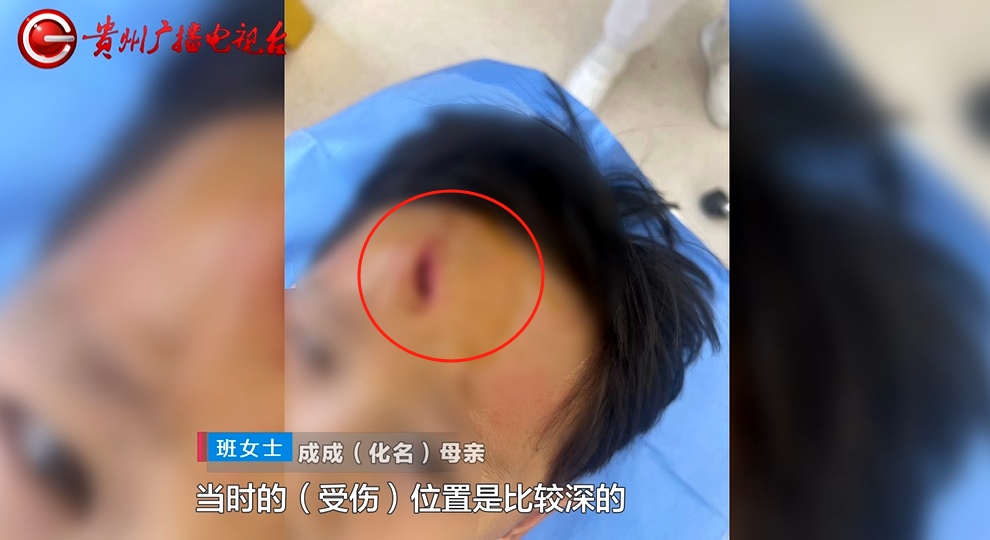 5岁男孩在游泳馆摔倒受伤,摔倒处没铺防滑垫!家长索赔却…… 5岁男孩在游泳馆摔倒受伤,摔倒处没铺防滑垫!家长索赔却……