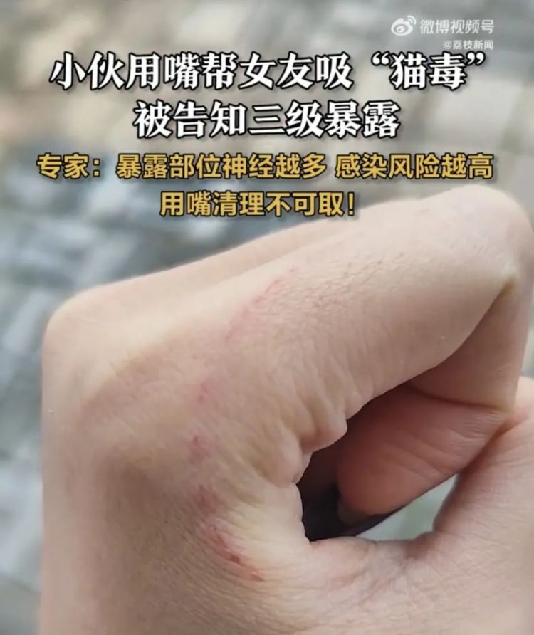 病死率近100%!这种疾病,可防不可治 病死率近100%!这种疾病,可防不可治