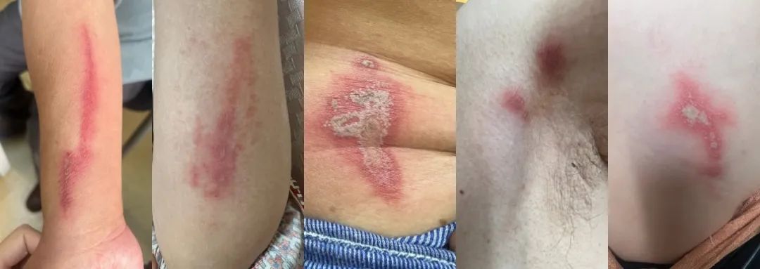 最近多人中招！再次提醒：遇到千万别打