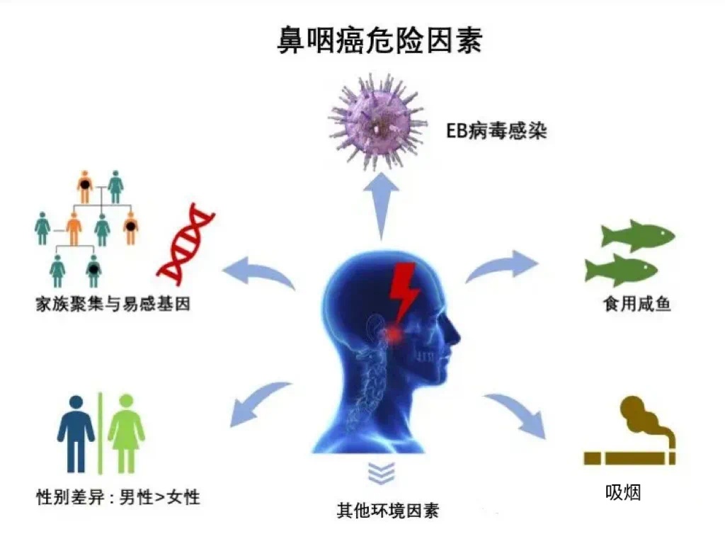鼻塞、流鼻血？请警惕！！！！这种病50%发生在我国！