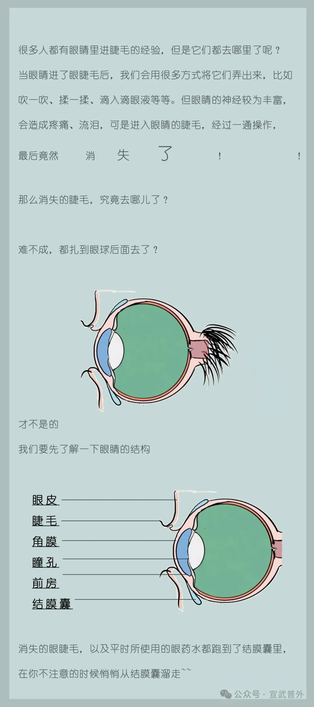 进眼睛里的眼睫毛最终都去哪了？