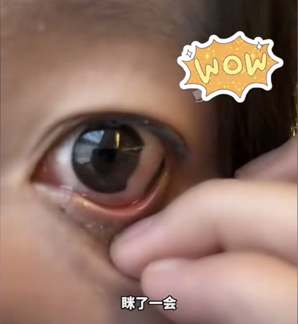 一觉醒来吓坏了，它在眼睛里碎了...