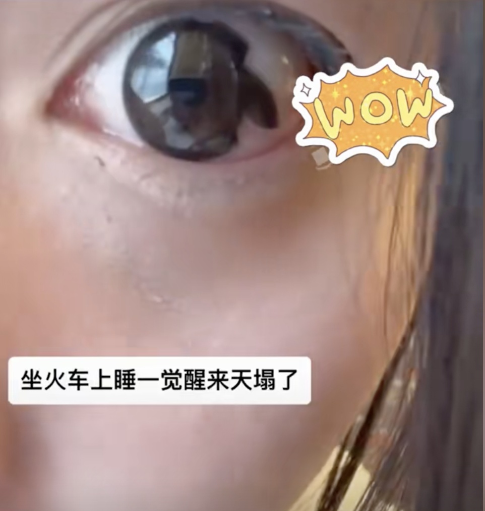 一觉醒来吓坏了，它在眼睛里碎了...
