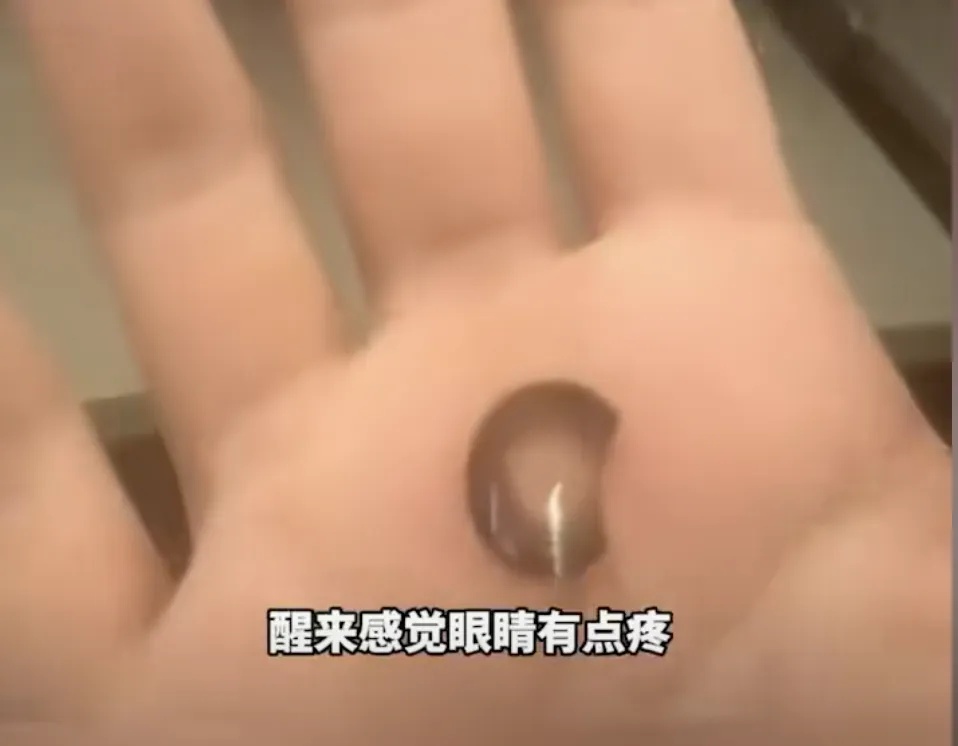 一觉醒来吓坏了，它在眼睛里碎了...