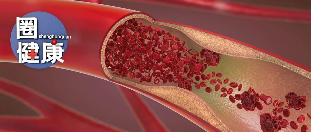 体检查出它别不在意,小心拖成癌!这5种“菌”能帮到你,秋季养生这样喝 体检查出它别不在意,小心拖成癌!这5种“菌”能帮到你,秋季养生这样喝