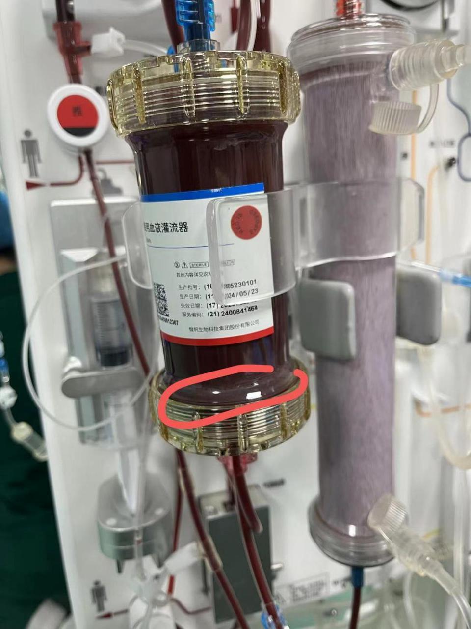 6至8瓶饮用水的量！26岁男子每天饮料不离手，血液沉淀后变成乳白色