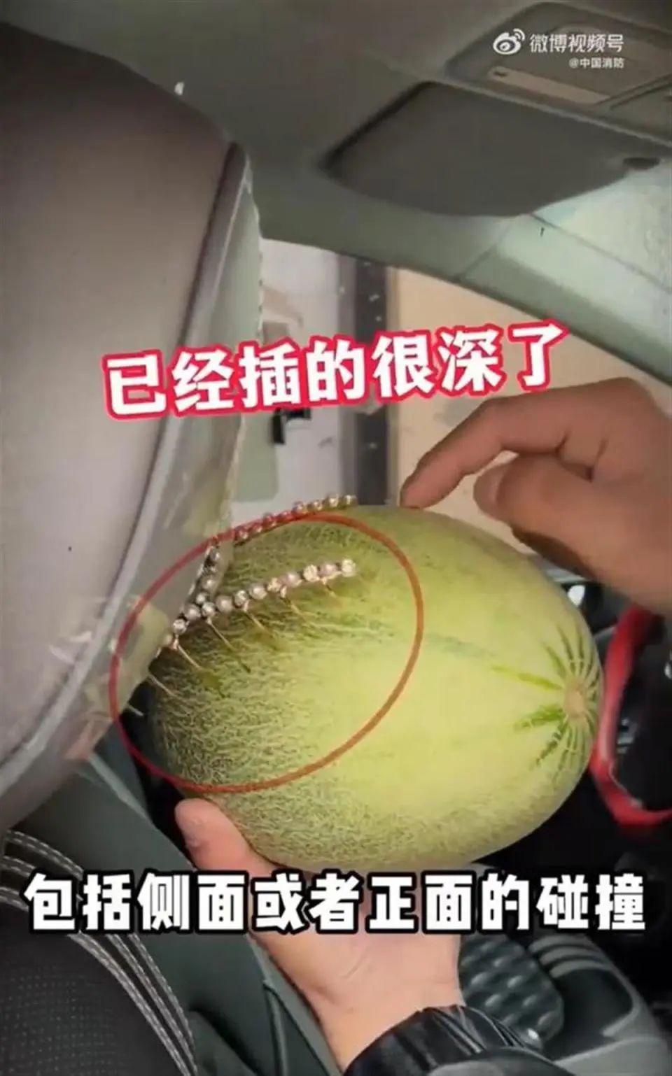 注意!这种发饰可致命!28岁女子摔倒后因它成植物人 注意!这种发饰可致命!28岁女子摔倒后因它成植物人