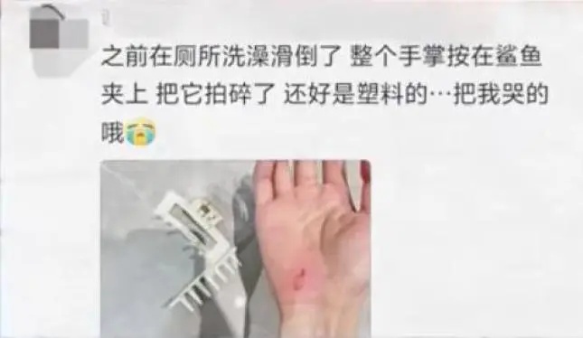网红鲨鱼夹再伤人，医生紧急提醒！