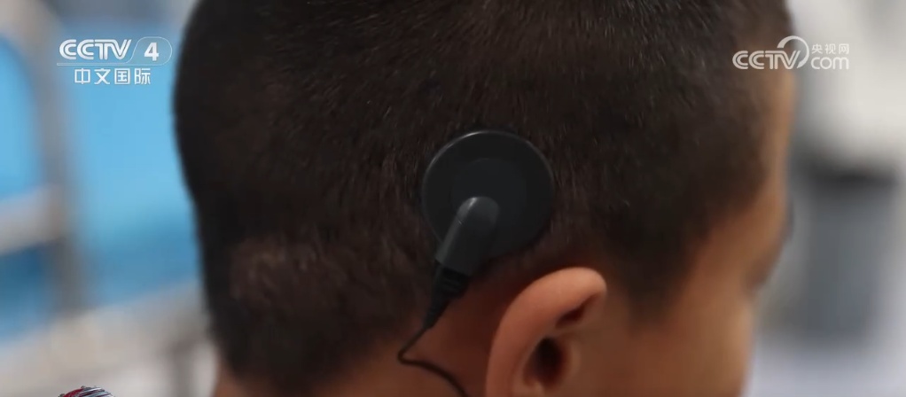 实事惠民生 人工耳蜗纳入多省医保 更多听障人士重获新“声” 实事惠民生 人工耳蜗纳入多省医保 更多听障人士重获新“声”