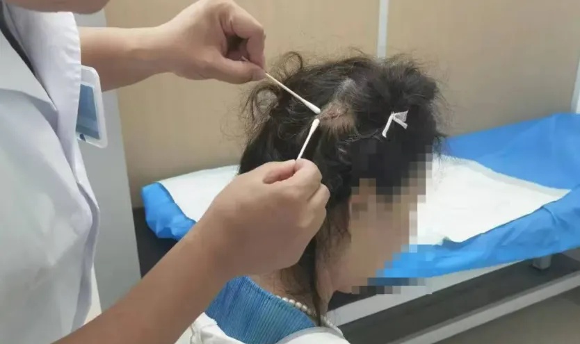 网红鲨鱼夹再伤人，医生紧急提醒！