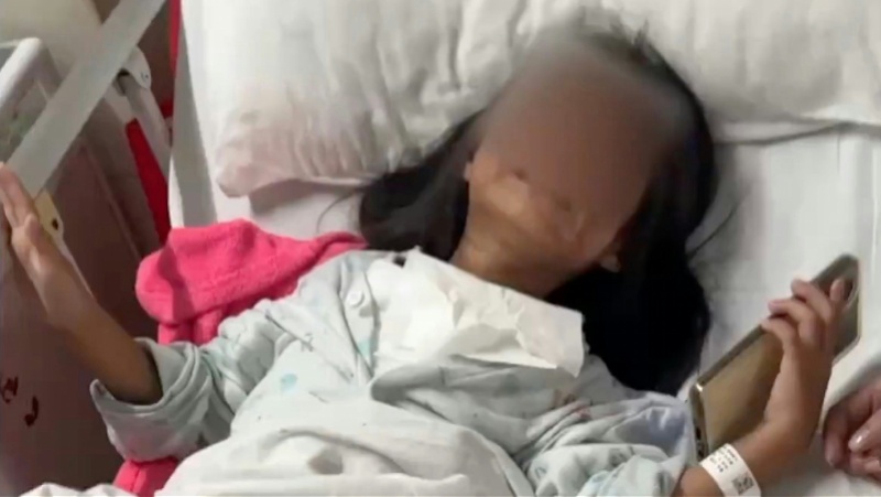 6岁女童被男生泼开水烫伤，最新情况！