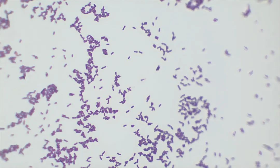 专挑宝宝、孕妇和老人下手!这种致病菌可能就藏在冰箱里 专挑宝宝、孕妇和老人下手!这种致病菌可能就藏在冰箱里