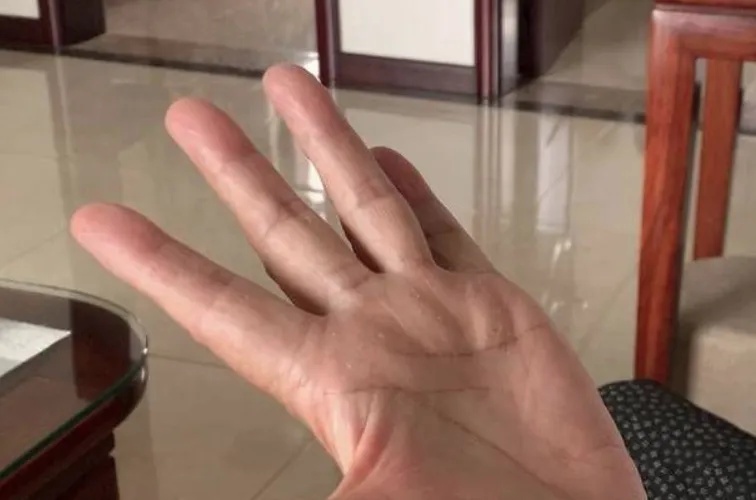 佛手瓜“有毒”？专家回应