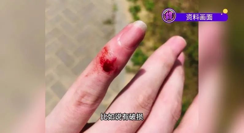 小心!女生做美甲竟感染HPV 医生提醒 小心!女生做美甲竟感染HPV 医生提醒