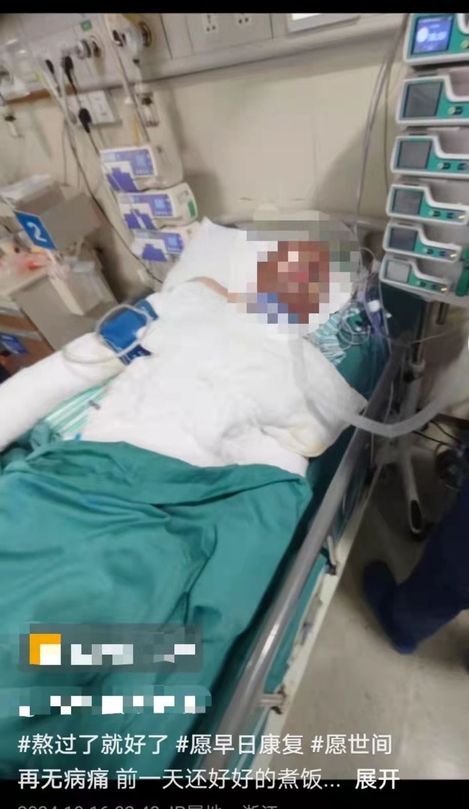 浙江一宝妈遇煤气爆炸严重烧伤，剧痛中第一反应是抱2岁儿子转移，丈夫：希望她快点好