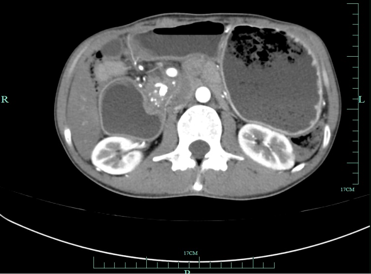 一男子突然确诊“癌王”!医生紧急提醒:这事做错了…… 一男子突然确诊“癌王”!医生紧急提醒:这事做错了……