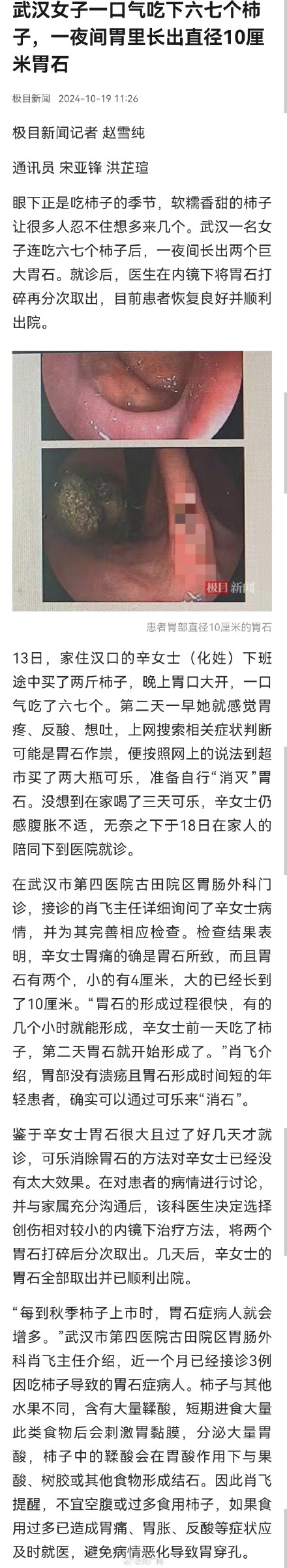 女子连吃多个柿子一夜长出巨大胃石 女子连吃多个柿子一夜长出巨大胃石