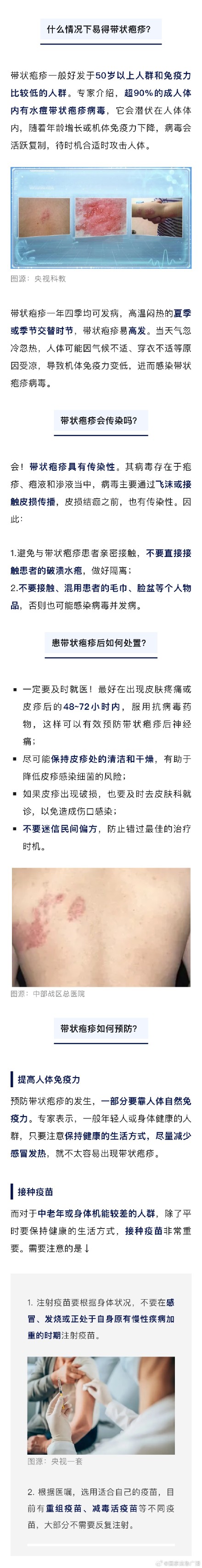 十级疼痛，传染性强！带状疱疹竟会长到眼睛里？