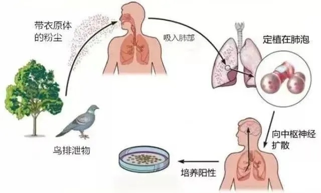 母女同患肺炎竟和家中鹦鹉有关？严重可致死！