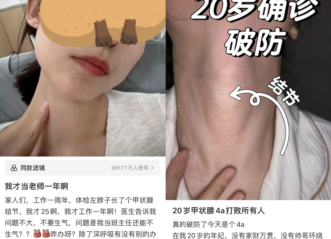 “每天摸800遍，像被判无期徒刑！”95后姑娘崩溃……医生：不少人都有