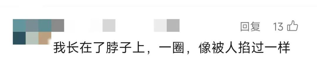 女子拆快递后确诊感染!疼痛难忍, 具有传染性…紧急提醒 女子拆快递后确诊感染!疼痛难忍, 具有传染性…紧急提醒