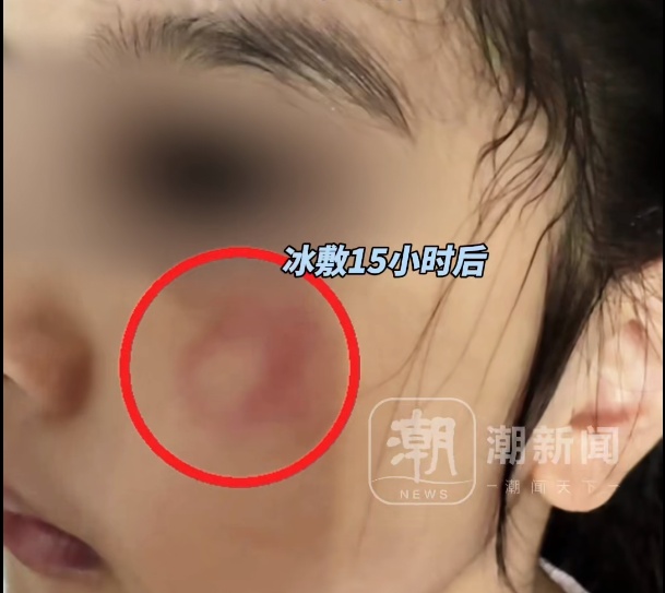 5岁女孩被教练抽球打脸?妈妈怒了!警方介入 5岁女孩被教练抽球打脸?妈妈怒了!警方介入