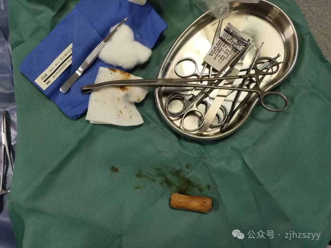 小伙竟将这东西塞进...医生紧急提醒！