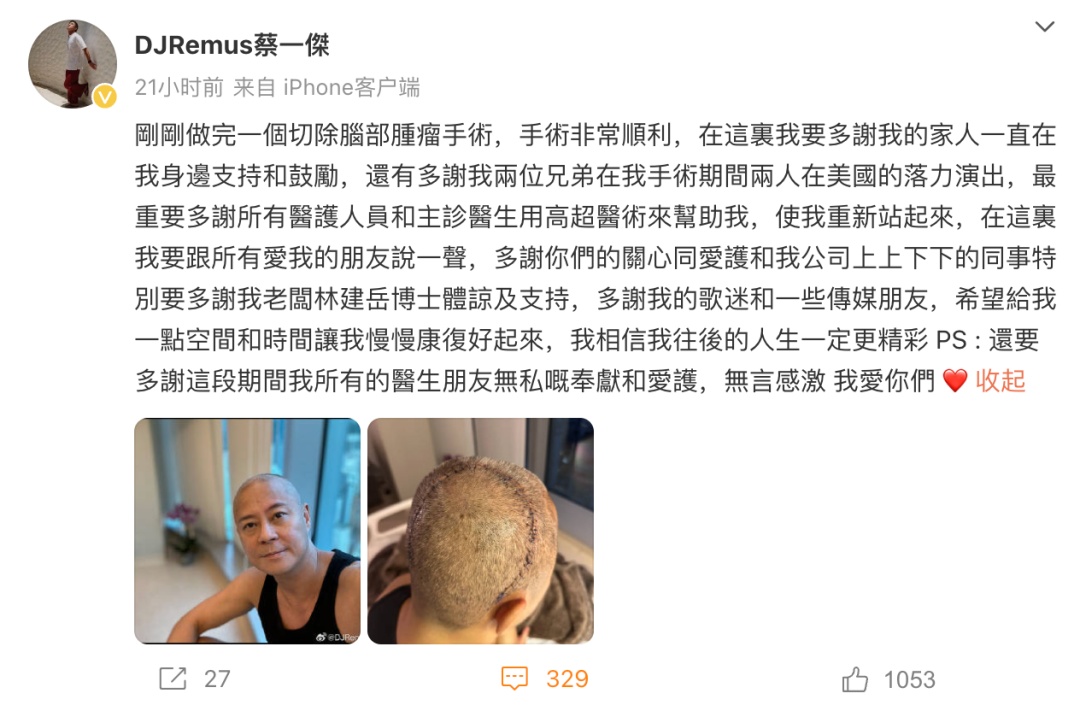 知名男歌手切除脑部肿瘤！警惕脑部肿瘤早期的10个信号