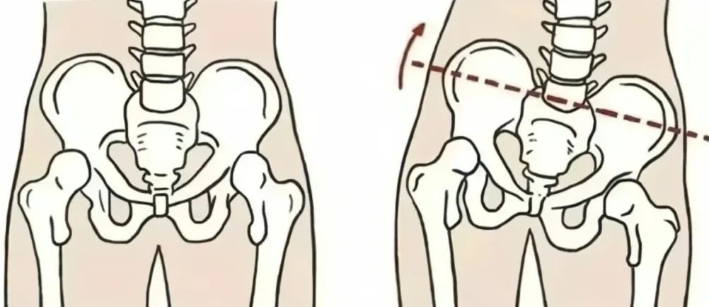 站没站相、坐没坐相?500万孩子腰板不直,80%无法自行矫正,教你10秒钟自测排查! 站没站相、坐没坐相?500万孩子腰板不直,80%无法自行矫正,教你10秒钟自测排查!