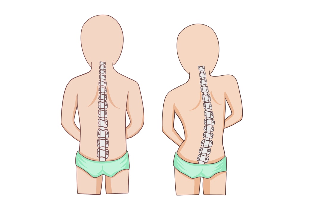 站没站相、坐没坐相?500万孩子腰板不直,80%无法自行矫正,教你10秒钟自测排查! 站没站相、坐没坐相?500万孩子腰板不直,80%无法自行矫正,教你10秒钟自测排查!