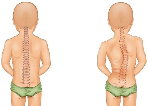 站没站相、坐没坐相?500万孩子腰板不直,80%无法自行矫正,教你10秒钟自测排查! 站没站相、坐没坐相?500万孩子腰板不直,80%无法自行矫正,教你10秒钟自测排查!