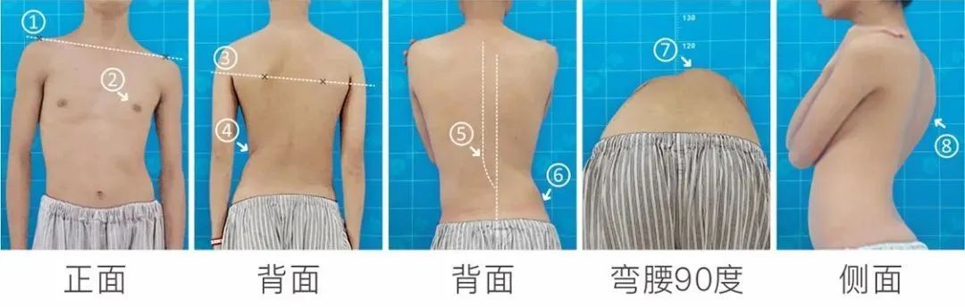 站没站相、坐没坐相?500万孩子腰板不直,80%无法自行矫正,教你10秒钟自测排查! 站没站相、坐没坐相?500万孩子腰板不直,80%无法自行矫正,教你10秒钟自测排查!