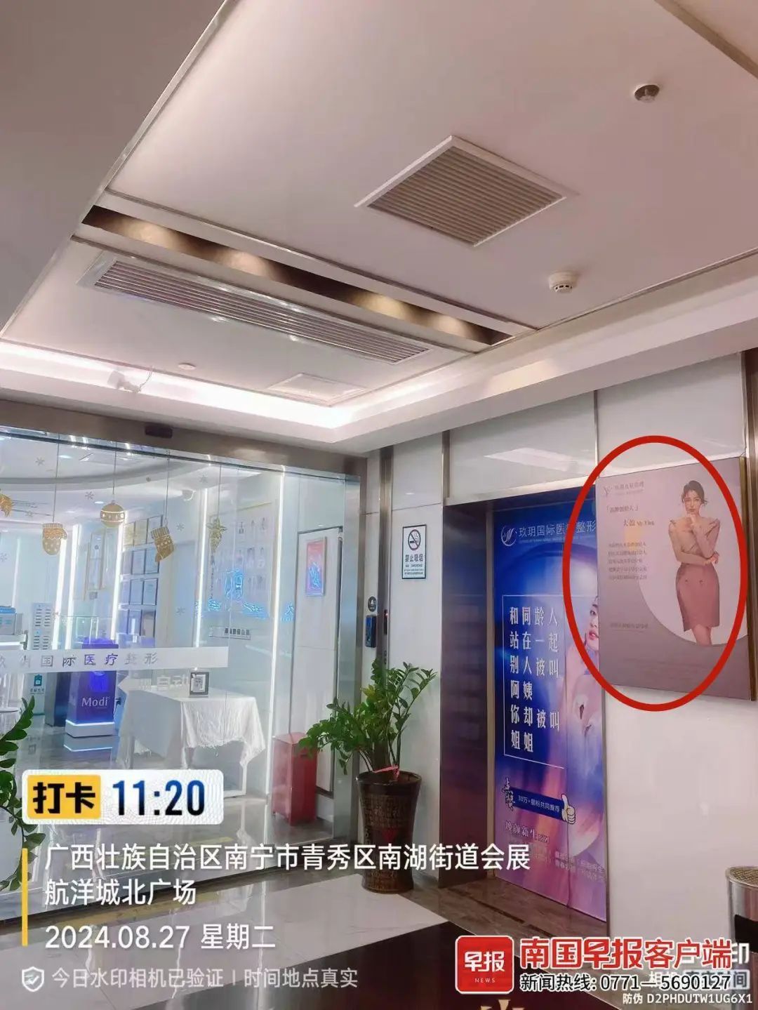 女子称花2.5万元打针，脸上出现凹坑！法院已立案受理