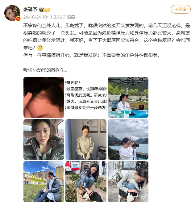 女演员张馨予自曝：斑秃了，“就很突然…”