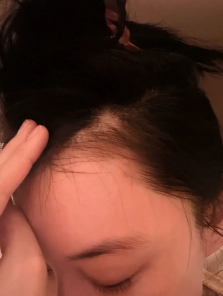 知名女演员发文:“就很突然地…”不少人也中招! 知名女演员发文:“就很突然地…”不少人也中招!