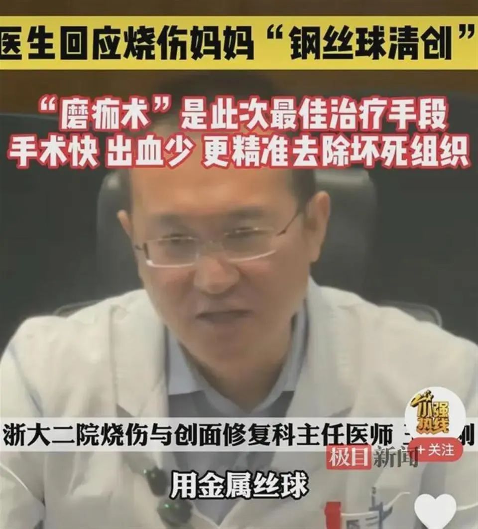 全身烧伤面积达65%,煤气爆炸她也要保护孩子!医生回应用钢丝球清创 全身烧伤面积达65%,煤气爆炸她也要保护孩子!医生回应用钢丝球清创