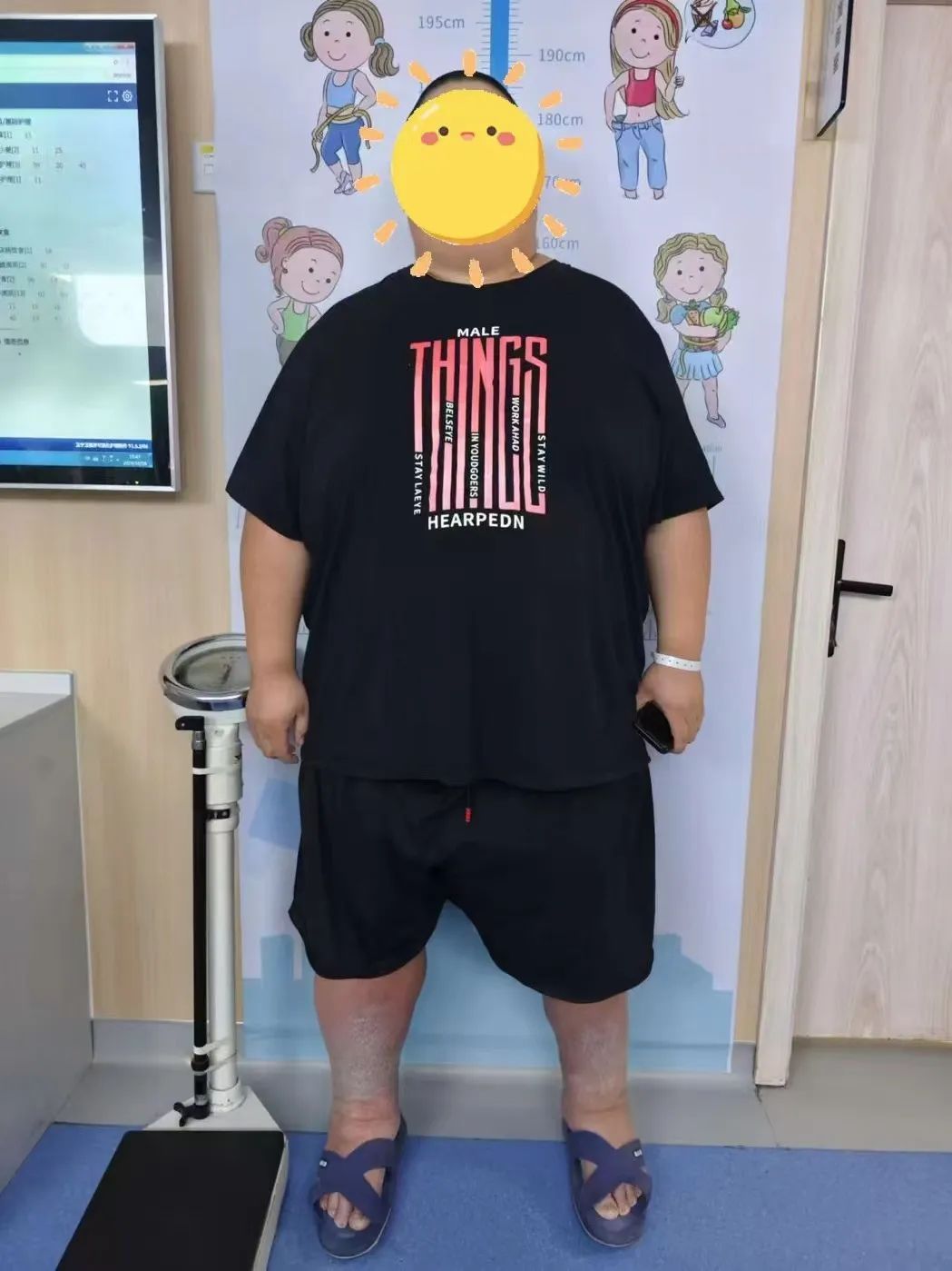 416斤!超肥胖患者在合肥完成减重手术 416斤!超肥胖患者在合肥完成减重手术