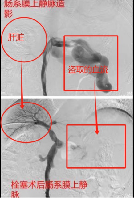 太诡异！每月昏迷一次，还把鞋子当尿壶！福州男子突然确诊……