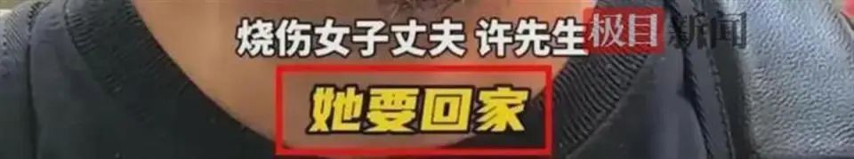 全身烧伤面积达65%,煤气爆炸她也要保护孩子!医生回应用钢丝球清创 全身烧伤面积达65%,煤气爆炸她也要保护孩子!医生回应用钢丝球清创