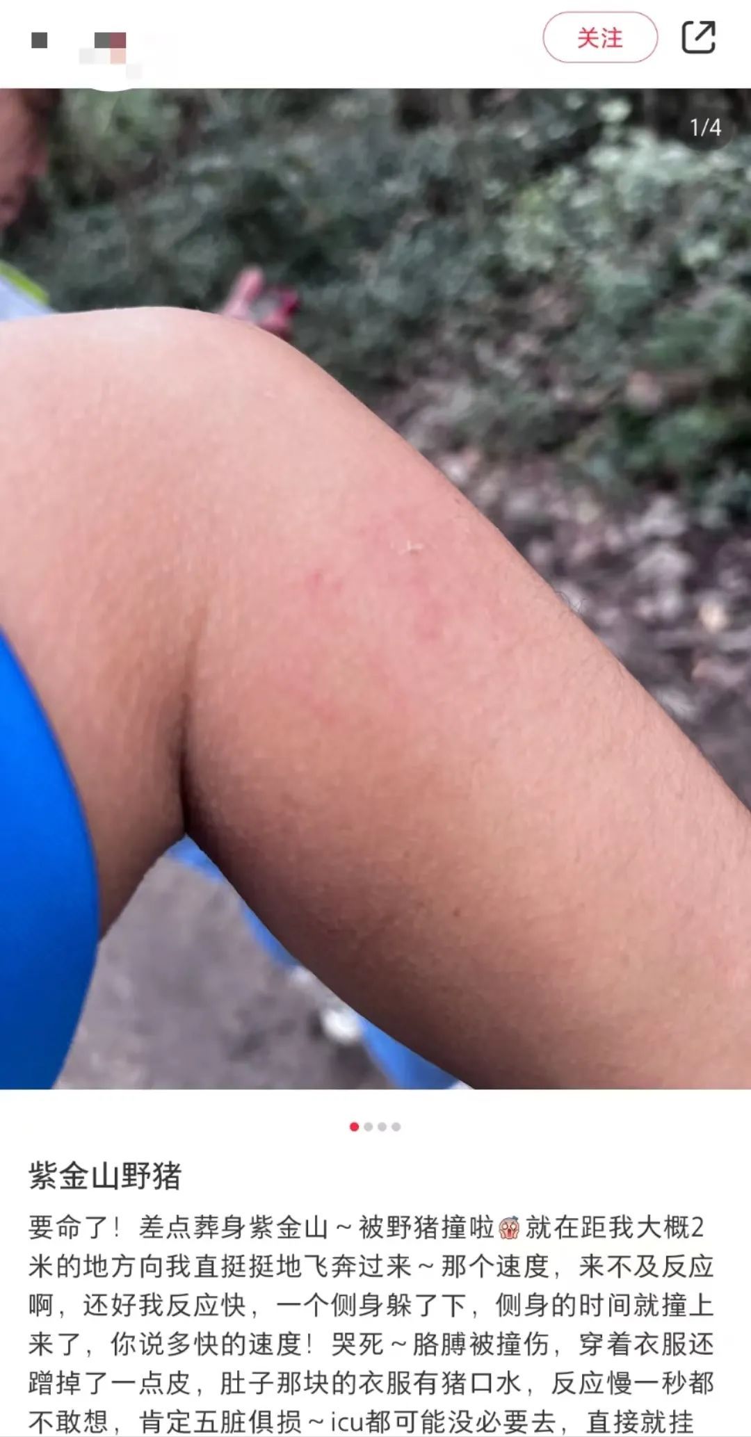 游客称爬南京紫金山走野路被野猪撞伤，管理方：很罕见