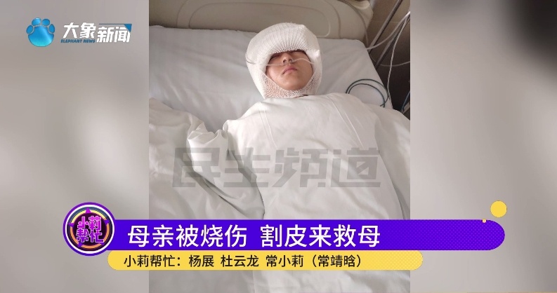 全身烧伤98%！18岁女儿第一个站了出来......