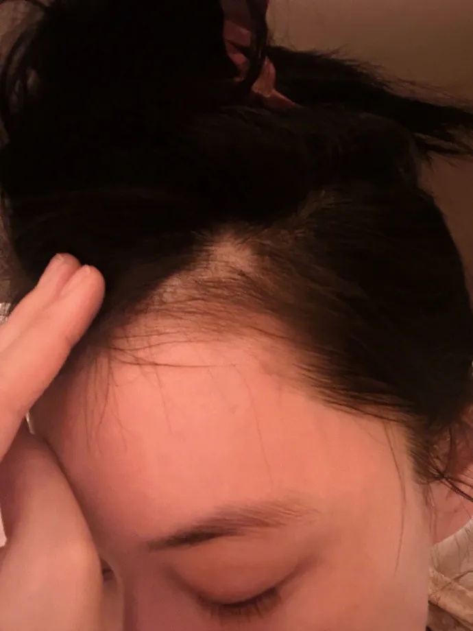 女演员自曝突然发病！不少人有同款烦恼