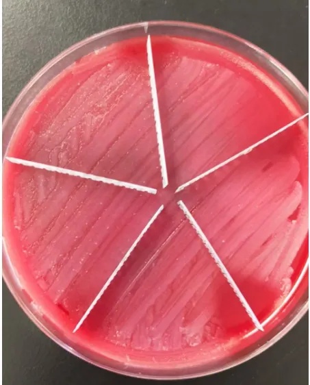“你太胖了吧！”25岁女子全身感染！一掀肚子令人崩溃...