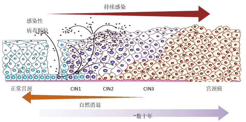 久拖成癌，女子后悔不已！这种病要重视......