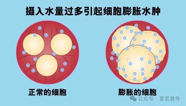什么是水中毒? 什么是水中毒?