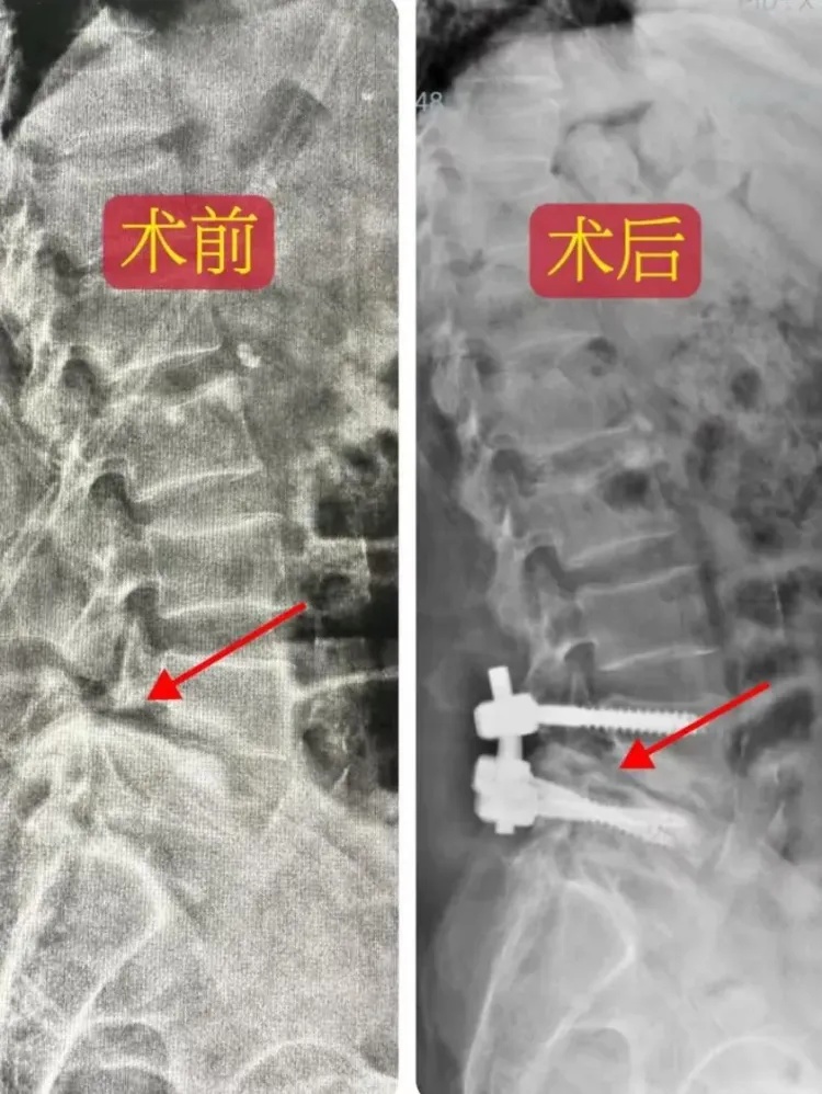 儿子烧了道菜，妈妈才吃几口就出事了！医生紧急提醒……